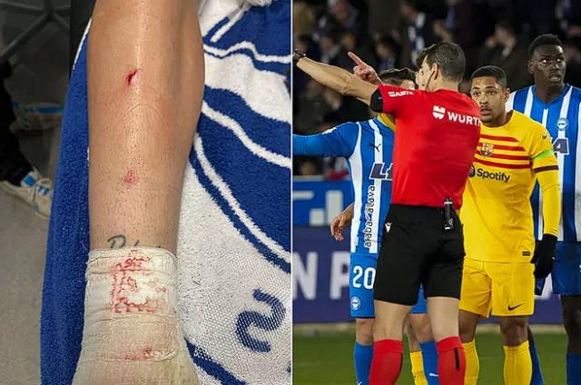 天博体育-小老虎被罚下，巴萨佐证自己喷皇马有理？